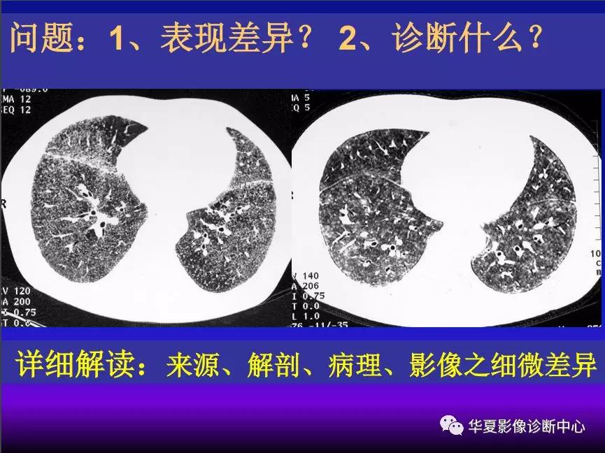 最新病理分析揭秘疾病背后的真相探索之旅